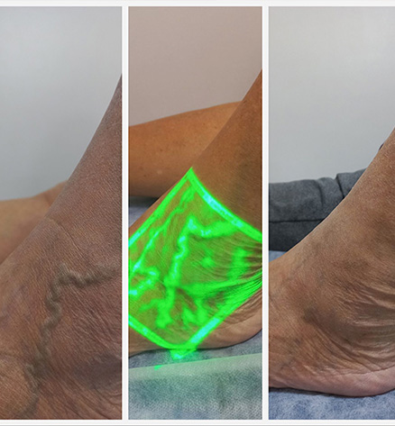 tratamientos-laser-sesiones-rapidas-y-comodas